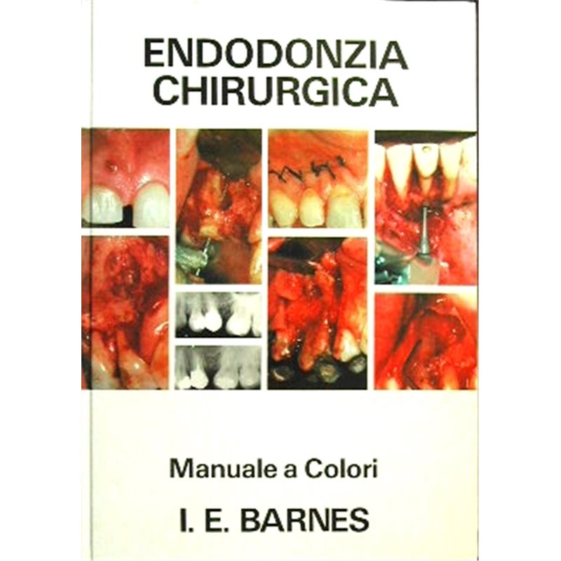 Endodonzia chirurgica - Manuale a colori